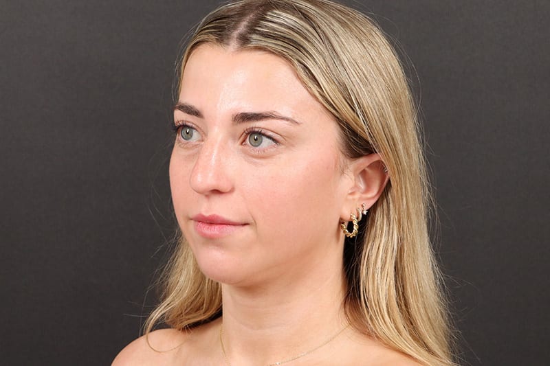 03-2024-10-02T014930.713